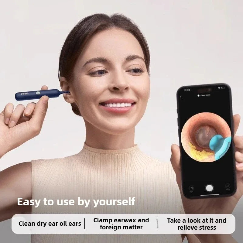 Xiaomi Bebird भिजुअल इयर क्लीनर HD क्लिपेबल ट्वीजर इयर पिकर वायरलेस क्लिनिङ एन्डोस्कोप क्यामेरा सहितको होम भिजुअल इयर स्कूप